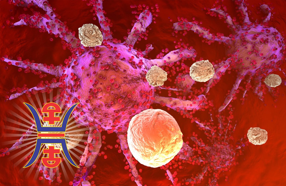 Acute-Granulocytic-Leukemia